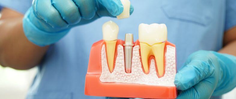 5 avances en tecnología dental que están revolucionando el cuidado de la salud bucal